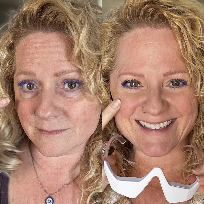 EyeLux Pro - Informacije