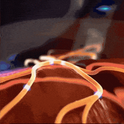 Microestímulos sequenciais