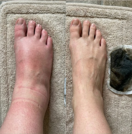 Resultado Fatima A. - Pernas mais leves