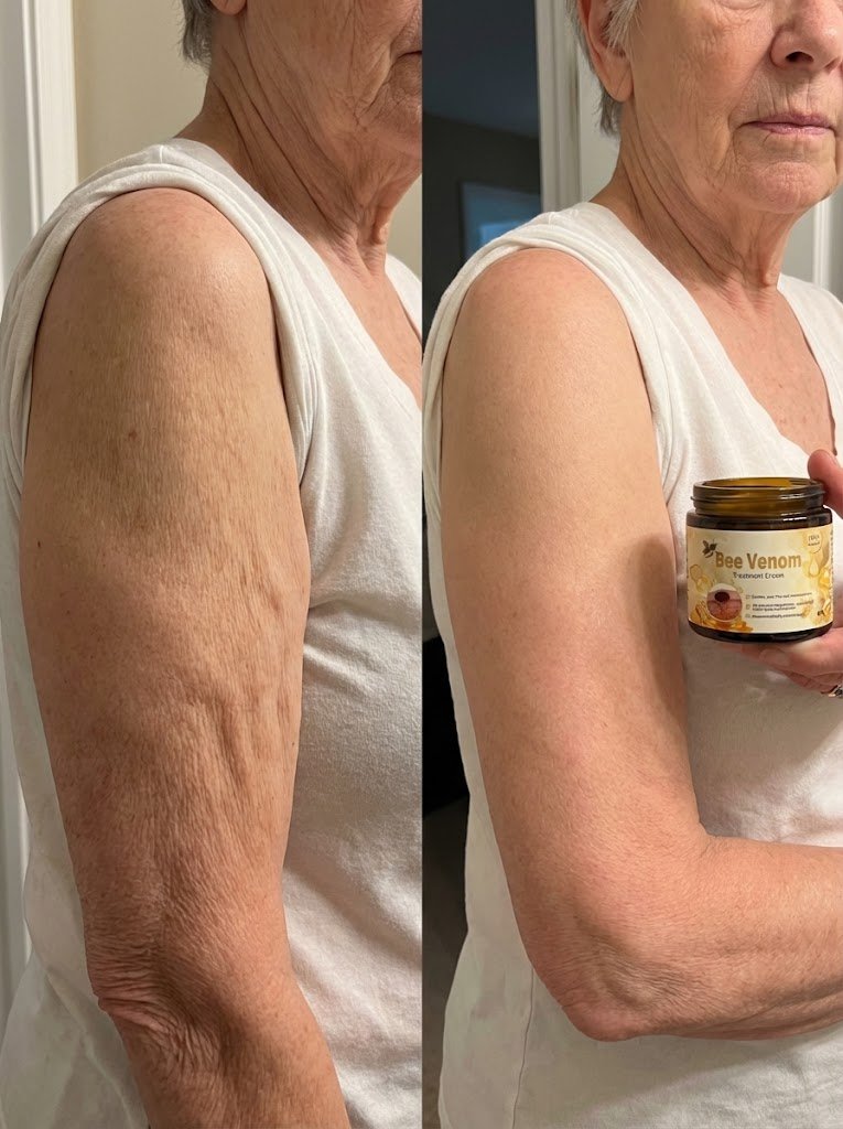 Resultado Carla P. - Pele mais luminosa