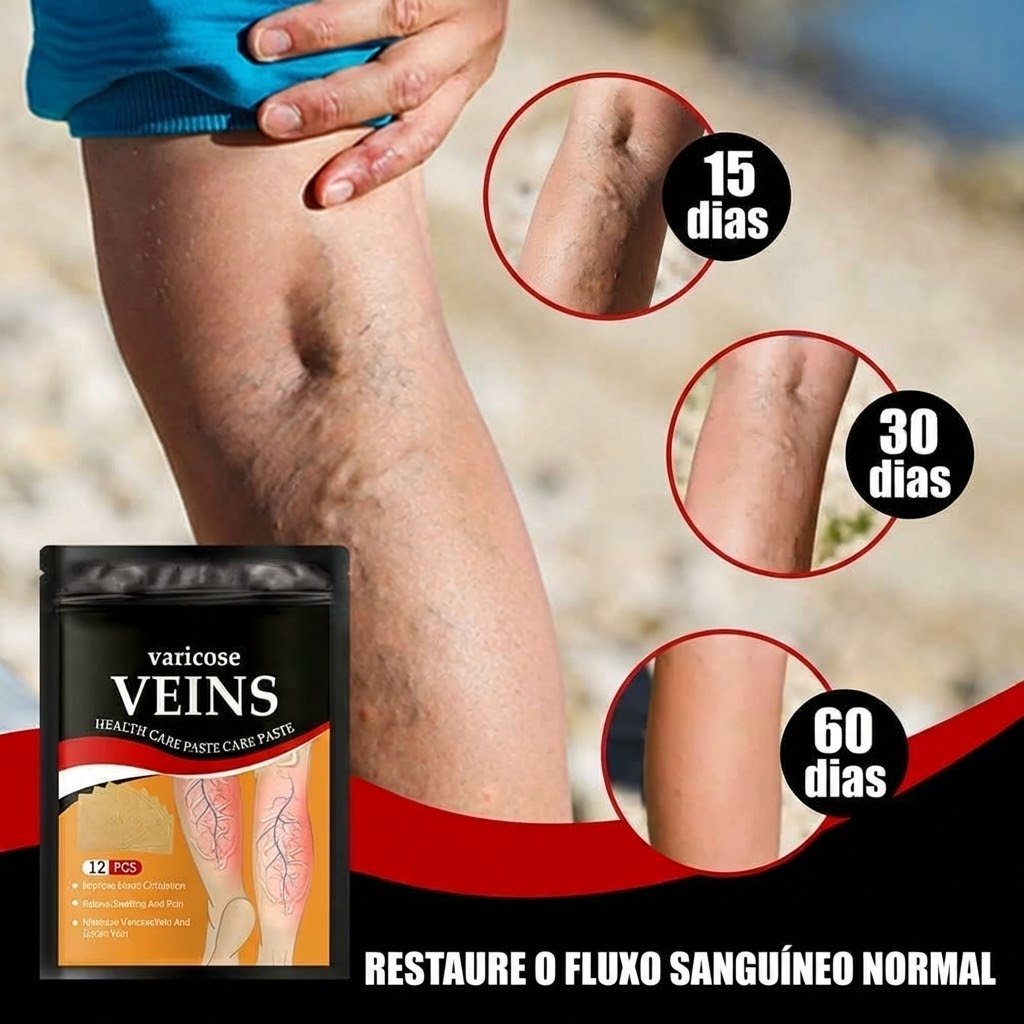 VenoVital - Adesivo de Alívio para Varizes em uso