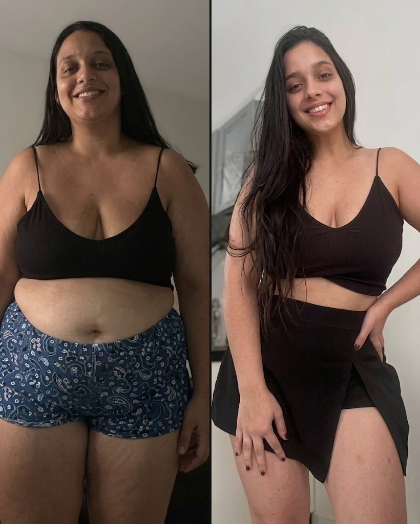 Resultado Teresa S. - Barriga mais lisa